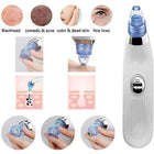 Electric Blackhead Remover Vacuum - Facial Pore Cleaner & Acne Extractor